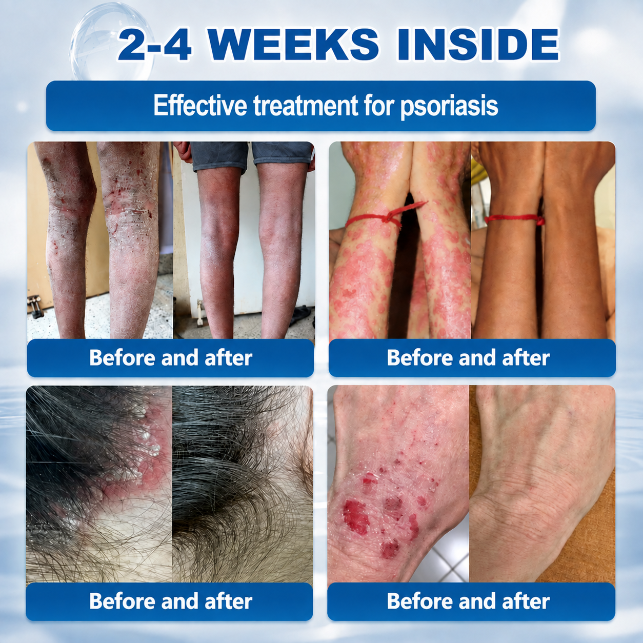 Natravor® 7-𝐃𝐚𝐲 𝐒𝐤𝐢𝐧 𝐓𝐚𝐠 & 𝐒𝐩𝐨𝐭 𝐄𝐫𝐚𝐬𝐞𝐫 𝐂𝐫𝐞𝐚𝐦 (Zero Pain, Zero 𝐒𝐜𝐚𝐫𝐬 Formula) 💎