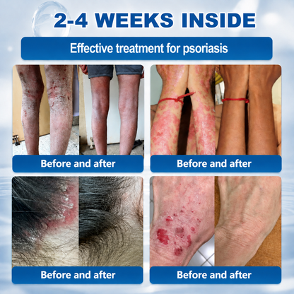 Natravor® 7-𝐃𝐚𝐲 𝐒𝐤𝐢𝐧 𝐓𝐚𝐠 & 𝐒𝐩𝐨𝐭 𝐄𝐫𝐚𝐬𝐞𝐫 𝐂𝐫𝐞𝐚𝐦 (Zero Pain, Zero 𝐒𝐜𝐚𝐫𝐬 Formula) 💎