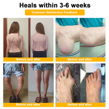 𝐎𝐟𝐟𝐢𝐜𝐢𝐚𝐥 𝐁𝐫𝐚𝐧𝐝 𝐒𝐭𝐨𝐫𝐞 |✅🔥Natravor® Joint Pain Relief Patches – 40 Mixed Sizes for Knees, Back, Shoulders