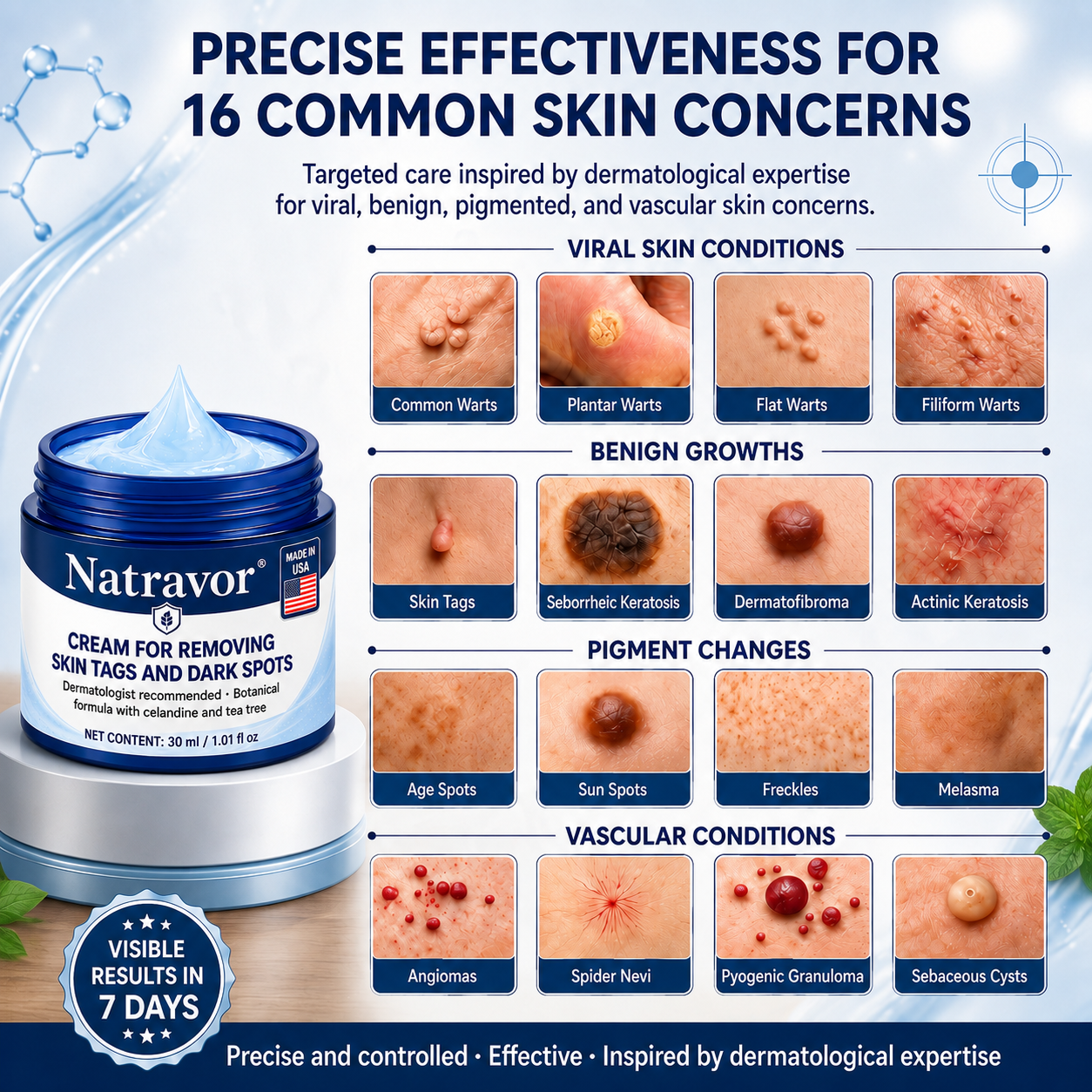Natravor® 7-𝐃𝐚𝐲 𝐒𝐤𝐢𝐧 𝐓𝐚𝐠 & 𝐒𝐩𝐨𝐭 𝐄𝐫𝐚𝐬𝐞𝐫 𝐂𝐫𝐞𝐚𝐦 (Zero Pain, Zero 𝐒𝐜𝐚𝐫𝐬 Formula) 💎