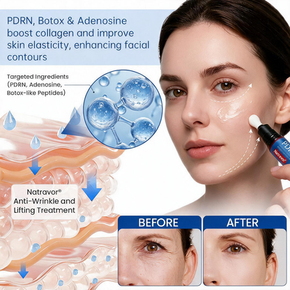 💠🔹🔷U HOT SALE Natravor® PDRN Anti-Wrinkle Shot – Lift & Firming Cream