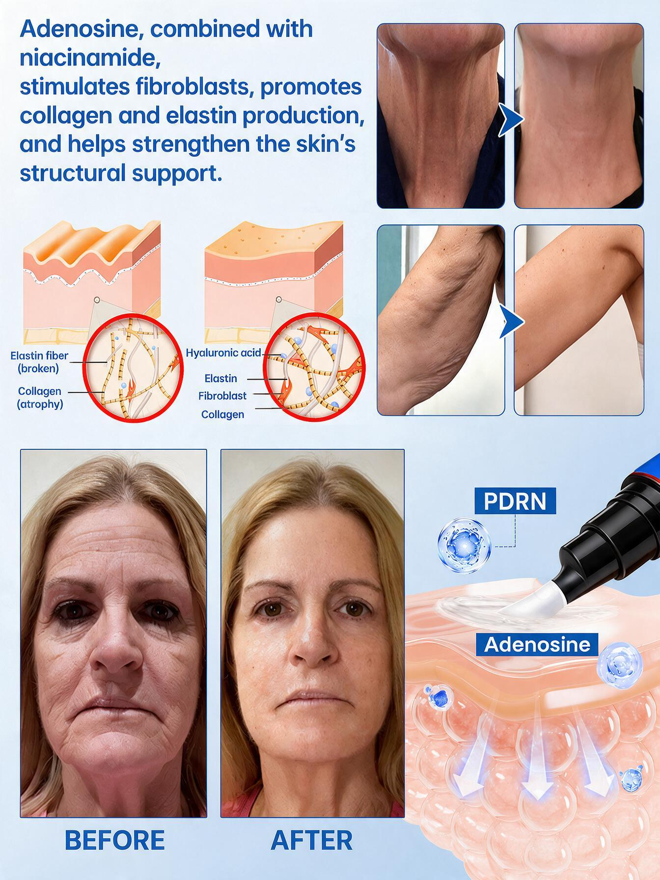 💠🔹🔷U HOT SALE Natravor® PDRN Anti-Wrinkle Shot – Lift & Firming Cream