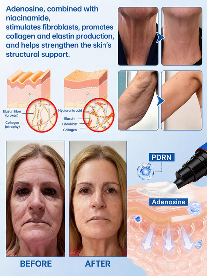💠🔹🔷U HOT SALE Natravor® PDRN Anti-Wrinkle Shot – Lift & Firming Cream