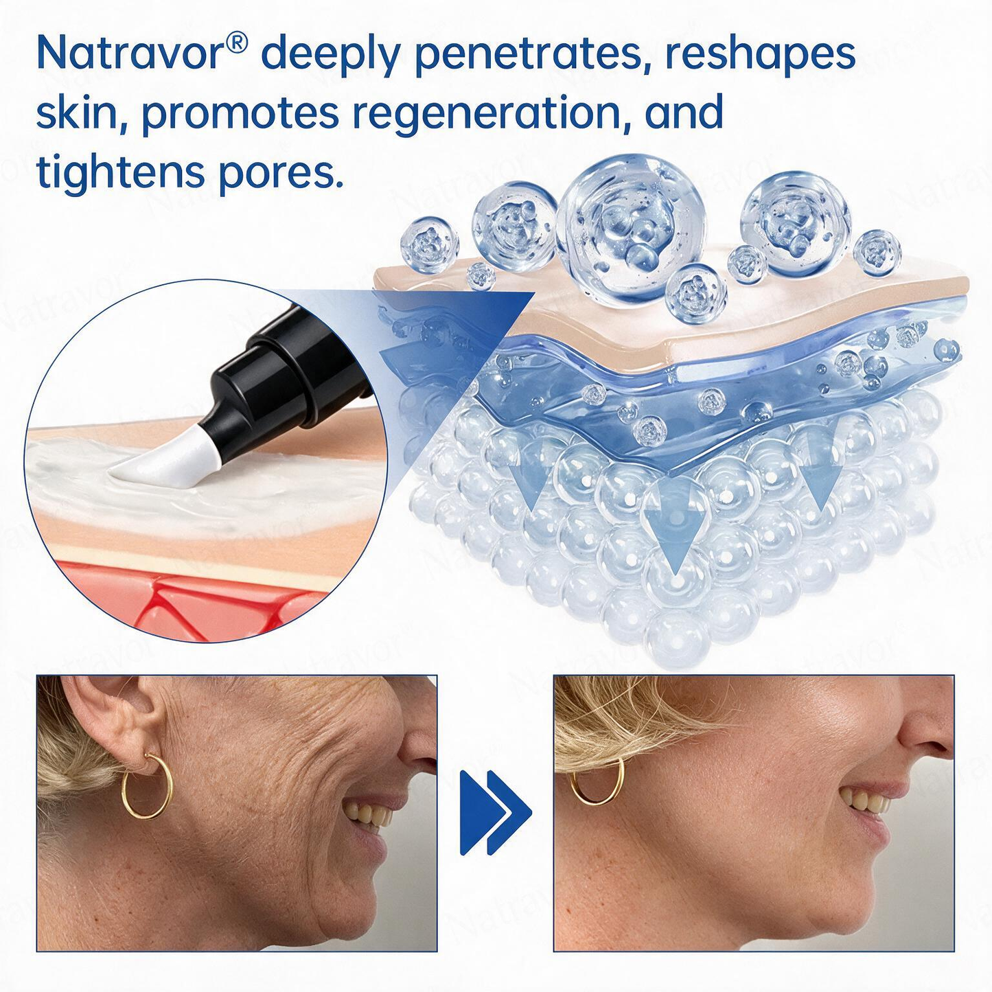 💠🔹🔷U HOT SALE Natravor® PDRN Anti-Wrinkle Shot – Lift & Firming Cream