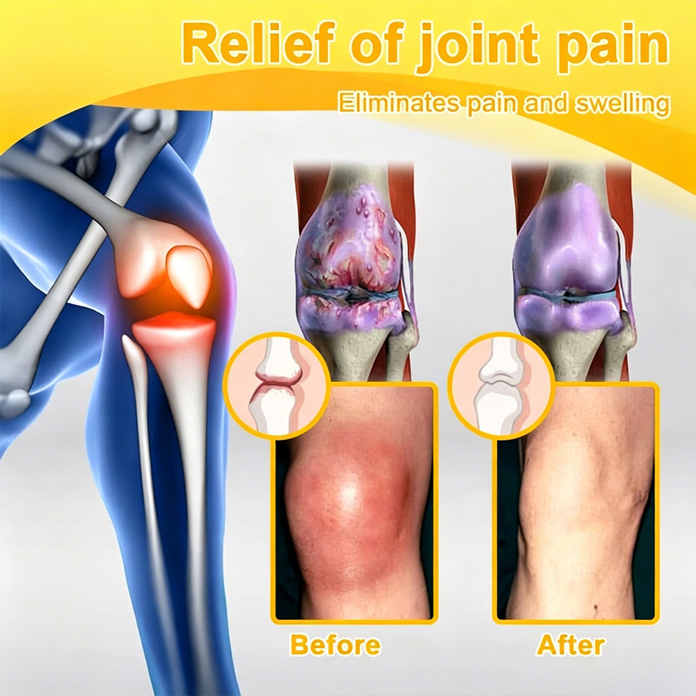 𝐎𝐟𝐟𝐢𝐜𝐢𝐚𝐥 𝐁𝐫𝐚𝐧𝐝 𝐒𝐭𝐨𝐫𝐞 |✅🔥Natravor® Joint Pain Relief Patches – 40 Mixed Sizes for Knees, Back, Shoulders