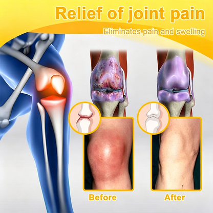 𝐎𝐟𝐟𝐢𝐜𝐢𝐚𝐥 𝐁𝐫𝐚𝐧𝐝 𝐒𝐭𝐨𝐫𝐞 |✅🔥Natravor® Joint Pain Relief Patches – 40 Mixed Sizes for Knees, Back, Shoulders