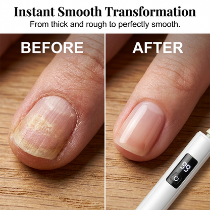 🥳2026 HOT SALE🥳💞50K+ SOLD!💅✨ 49% OFF! Professional Electric Nail Polisher – Smooths thick nails. 99-speed display. Multiple heads for shaping & buffing. Salon at home! 🌟💎